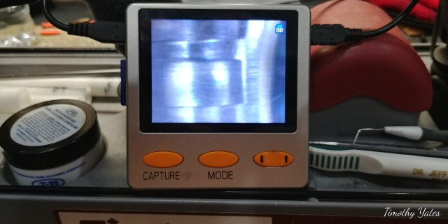7113176