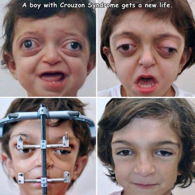 1636555982_qwwrlra33h.jpg