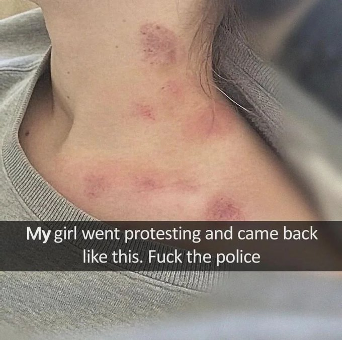 1709836820657.png
