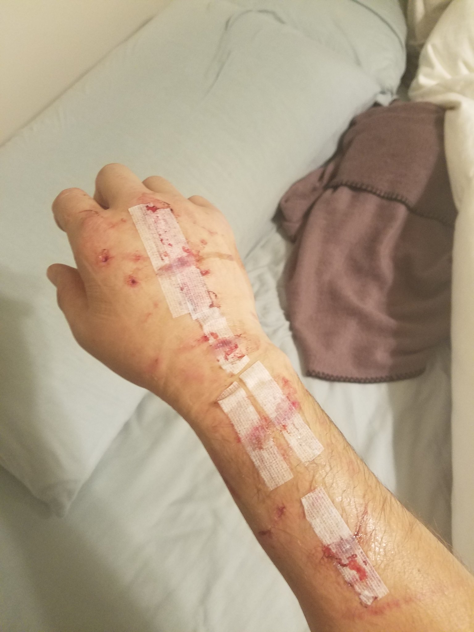 20171129_220655.jpg