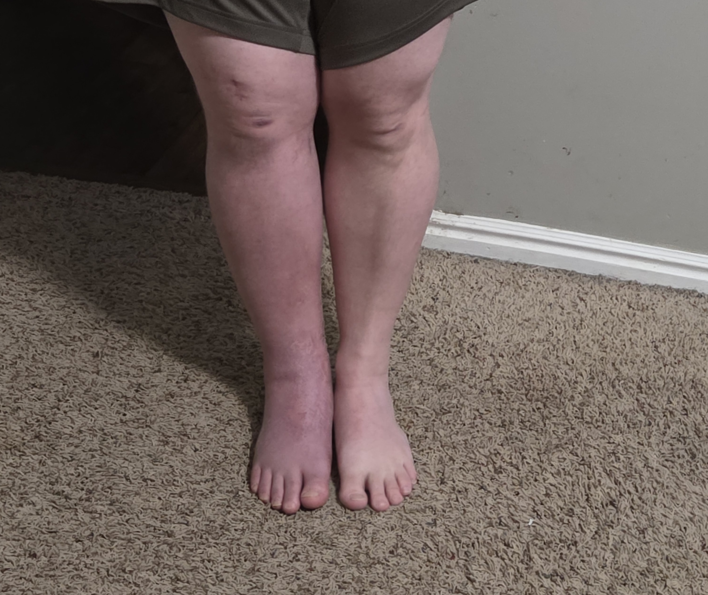 20250812_204344.jpg