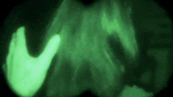 A8801889-7F17-4FFA-B71D-B6DD8FC516B3.gif