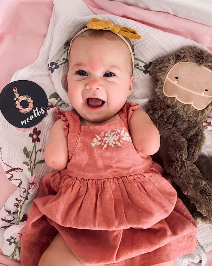 baby-born-without-hands-ivy-jane-7.jpg