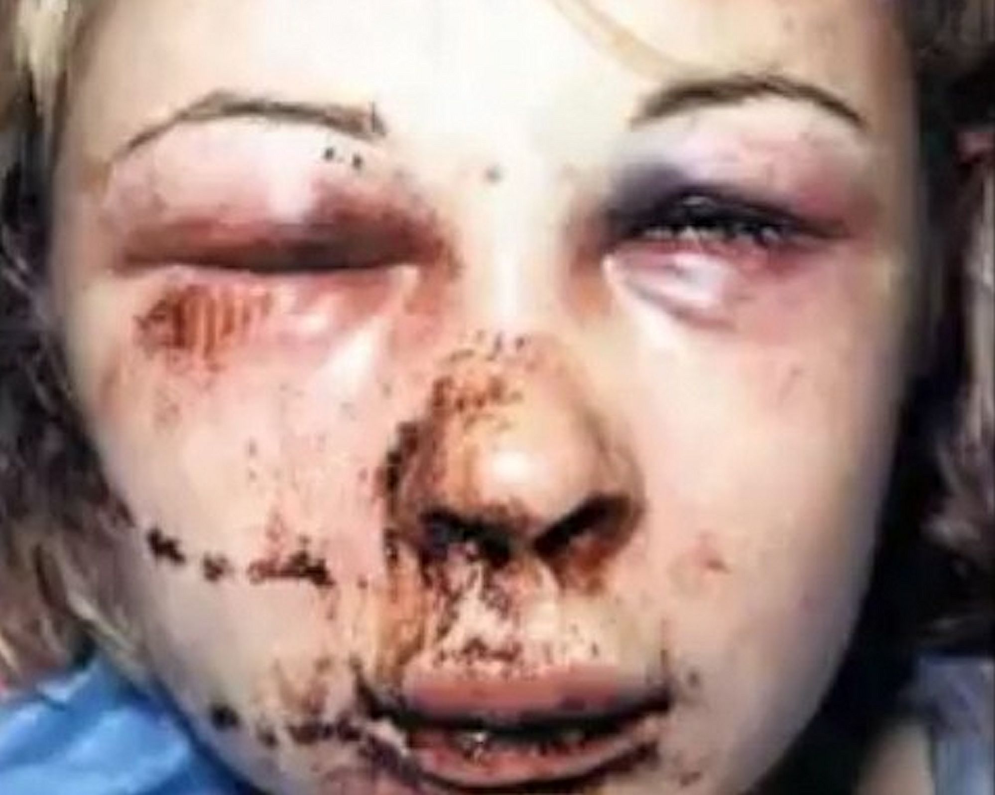 battered-woman1.jpg