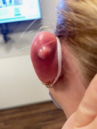 ear.jpg