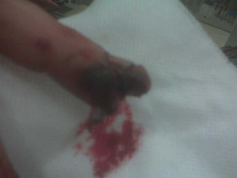 finger2.jpg