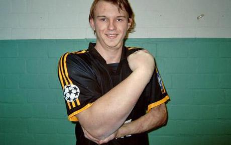 Forearm.jpg