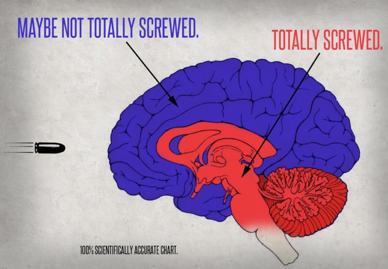 Gun-shot-to-brain-diagram-768x533.jpg