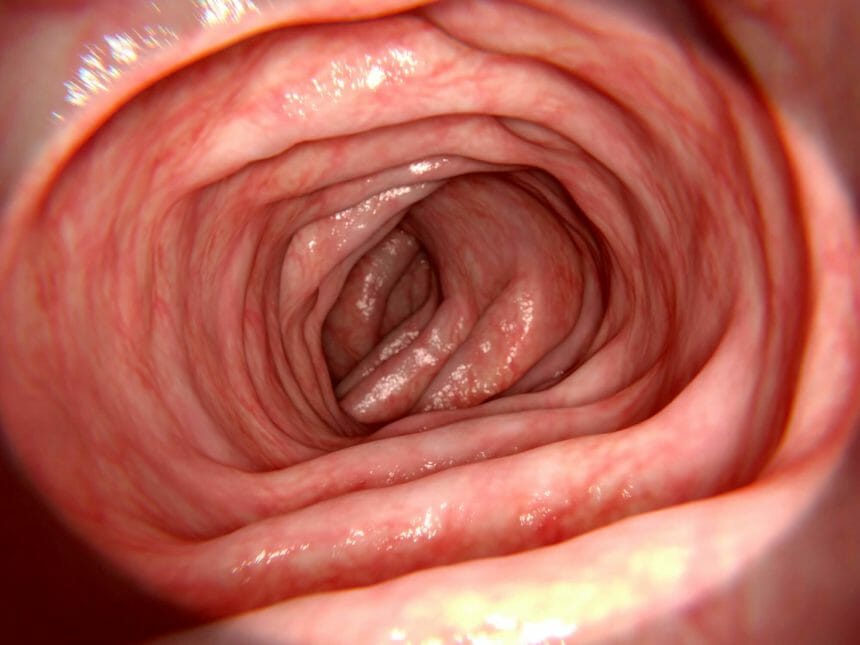 healthy-intestine_G_724236381-860x645.jpg