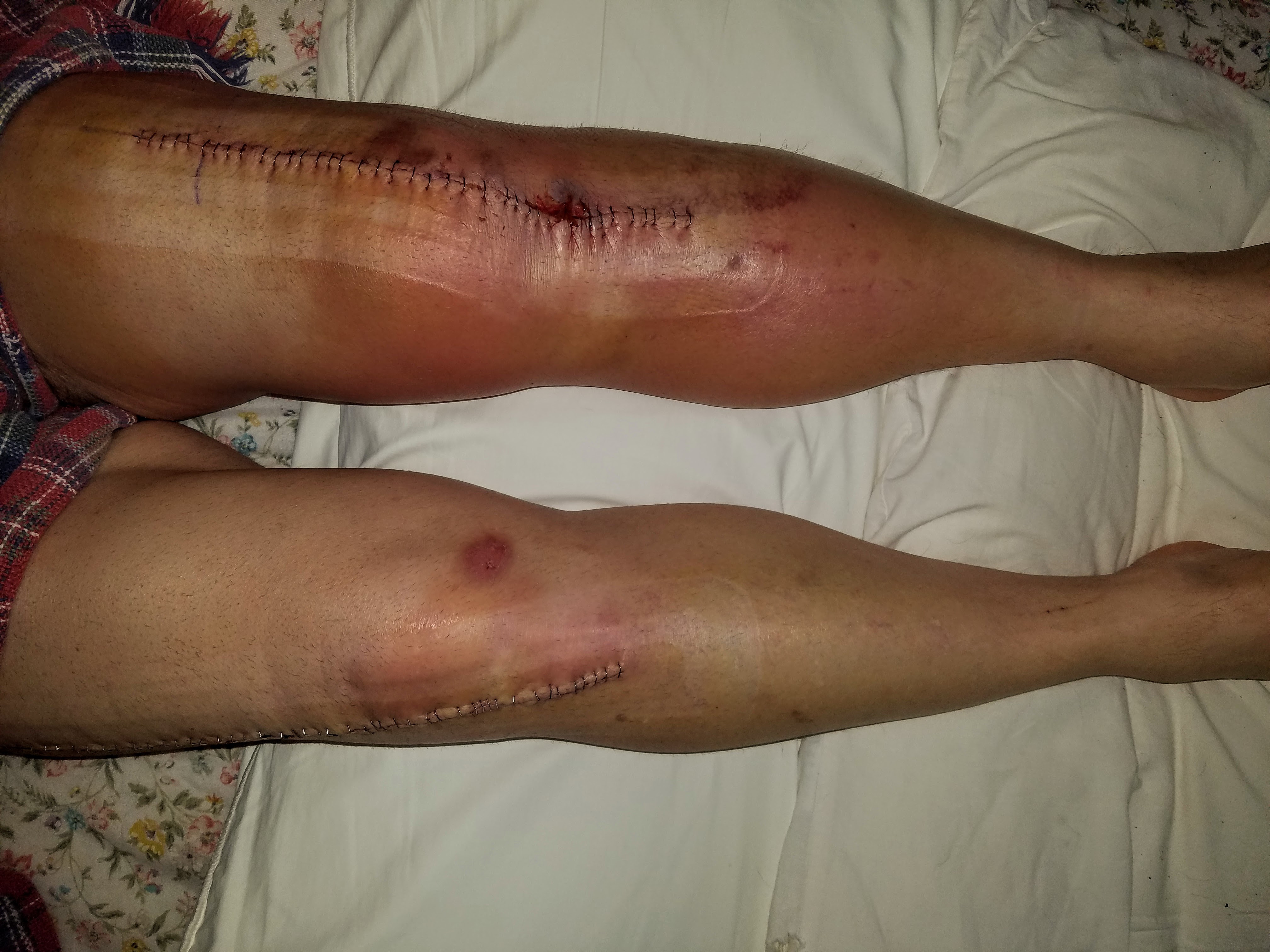 Knee Surgery.jpg