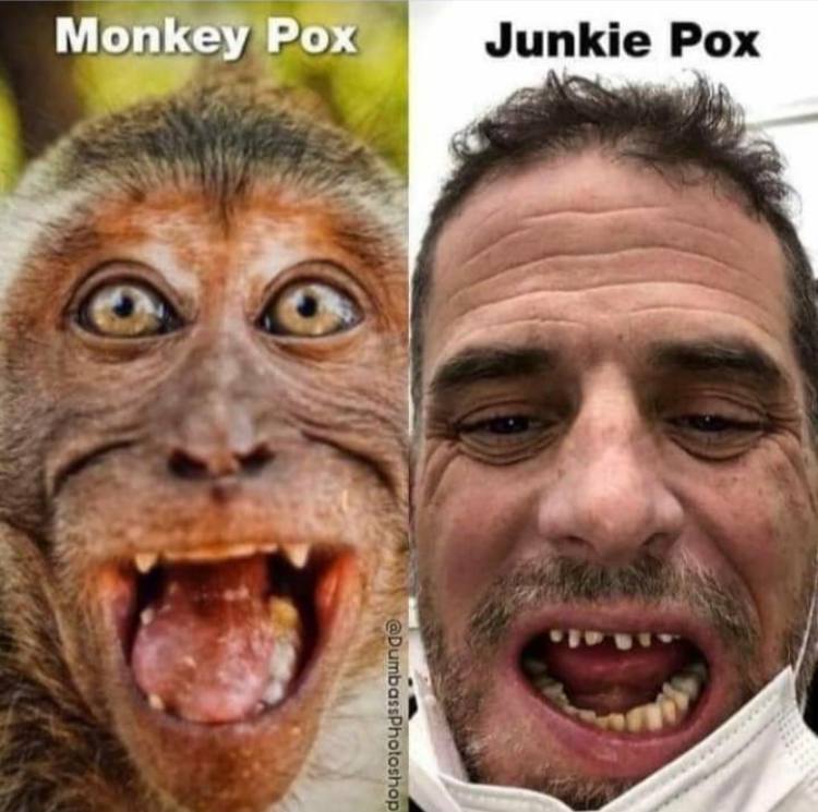 pox.jpg