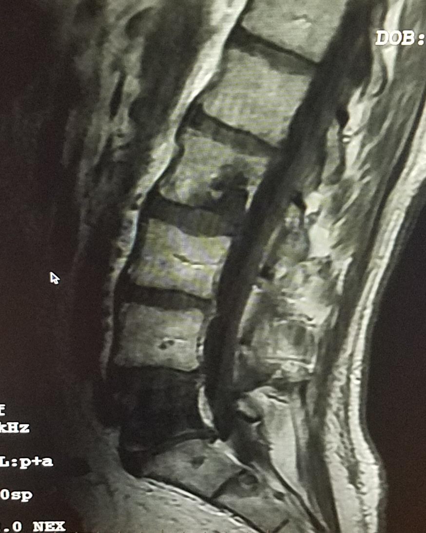 spine.jpg