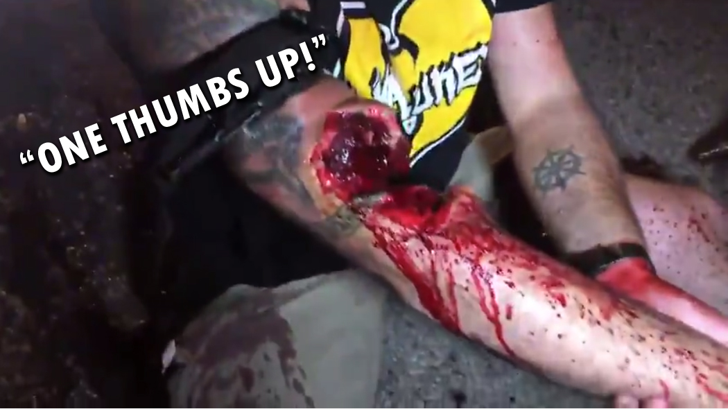 THUMBS.jpg