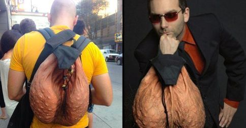 UNILAD.ballsack.6318766553.jpg
