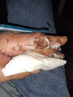hand.jpg
