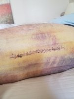 sutures.jpg